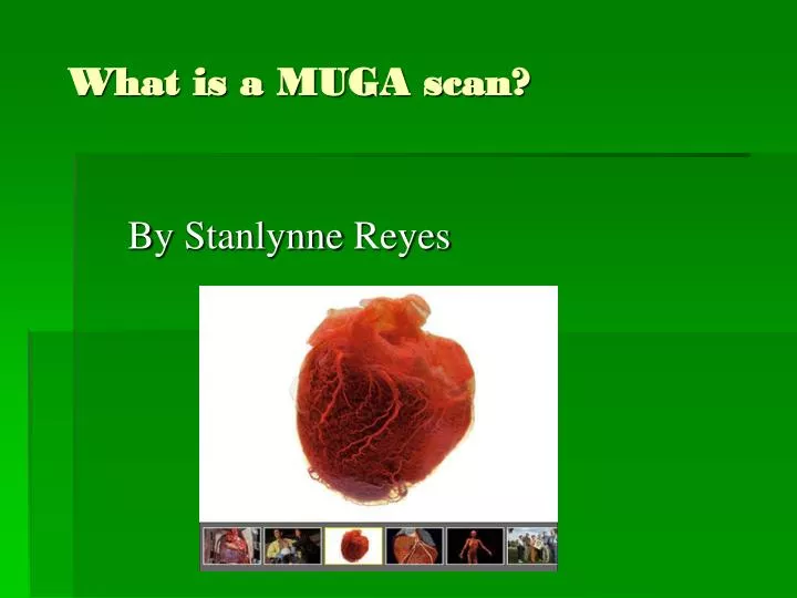what is a muga scan
