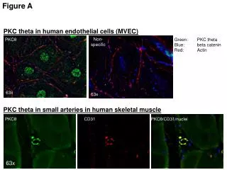 PKC theta in human endothelial cells (MVEC)