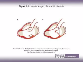 Figure 2 Schematic images of the MV in diastole