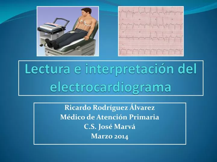 lectura e interpretaci n del electrocardiograma