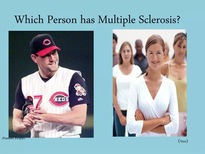 which person has multiple sclerosis