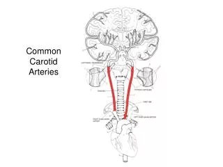 Common Carotid Arteries