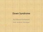 Down Syndrome - slide 1