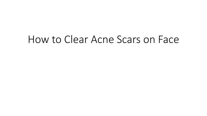 how to clear acne scars on face