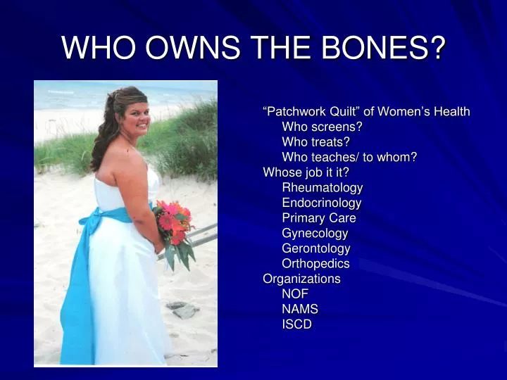 who owns the bones