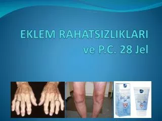 eklem rahatsizliklari ve p c 28 jel