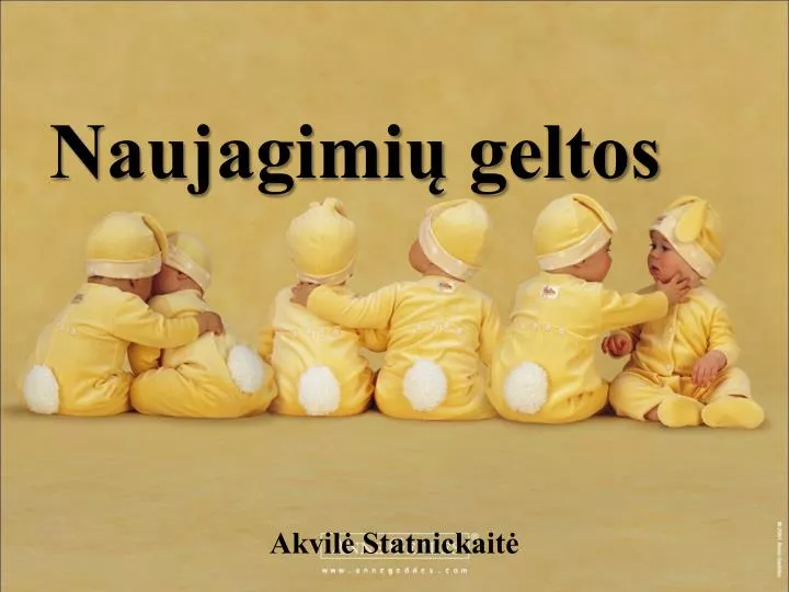 naujagimi geltos