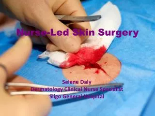 Nurse-Led Skin Surgery