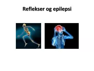 reflekser og epilepsi