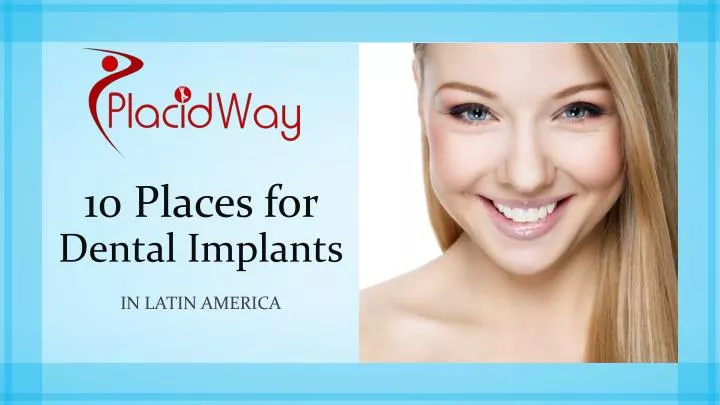 10 places for dental implants