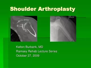 Shoulder Arthroplasty