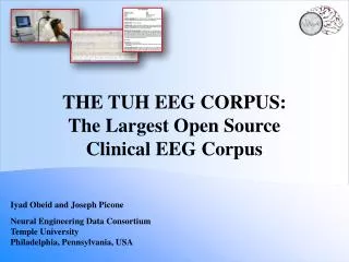 The TUH EEG COrpus : The Largest Open Source Clinical EEG Corpus