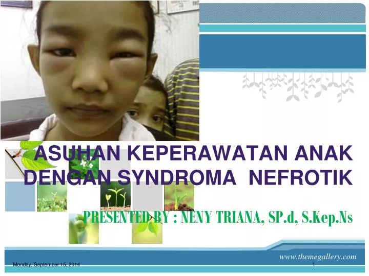 asuhan keperawatan anak dengan syndroma nefrotik presented by neny triana sp d s kep ns