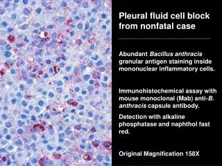 Pleural fluid cell block from nonfatal case
