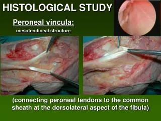 Peroneal vincula: mesotendineal structure