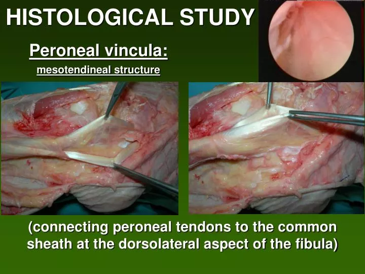peroneal vincula mesotendineal structure