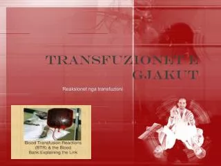 transfuzionet e gjakut