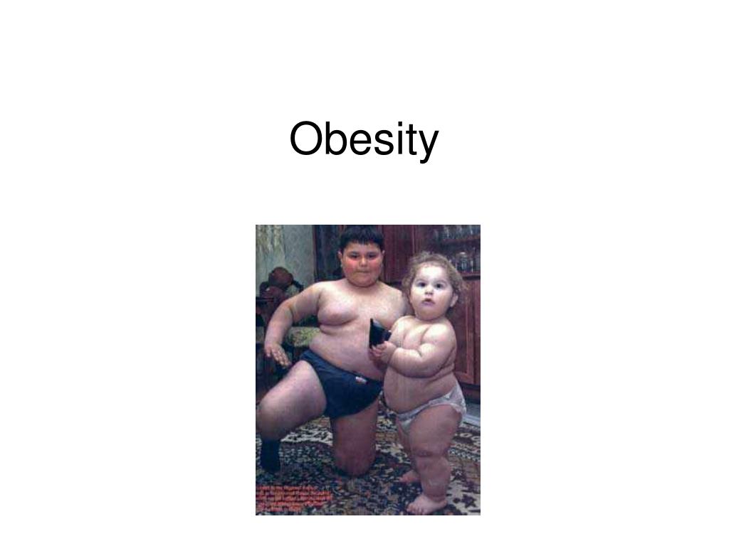 Obesity - slide 1