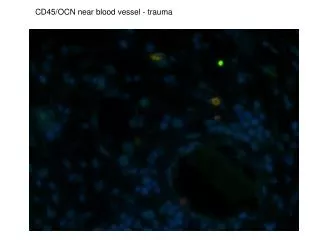 CD45/OCN near blood vessel - trauma