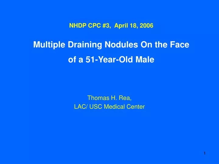nhdp cpc 3 april 18 2006 multiple draining nodules on the face of a 51 year old male