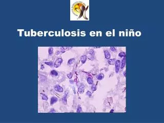 tuberculosis en el ni o