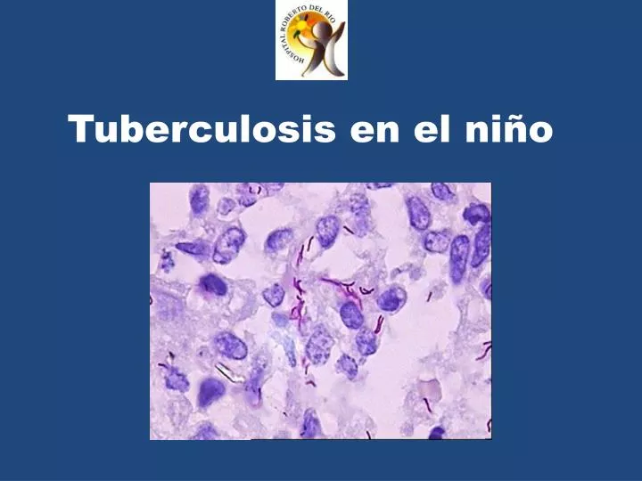 tuberculosis en el ni o