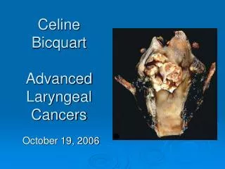 Celine Bicquart Advanced Laryngeal Cancers