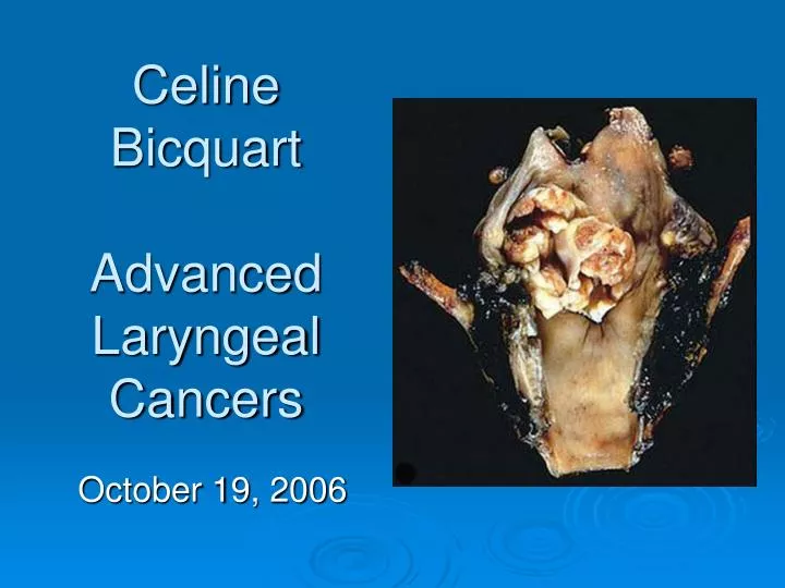 celine bicquart advanced laryngeal cancers