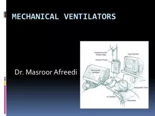 Mechanical Ventilators