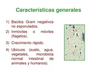caracter sticas generales