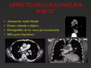 aspecto de los ganglios por tc