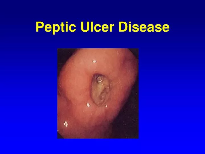 peptic ulcer disease