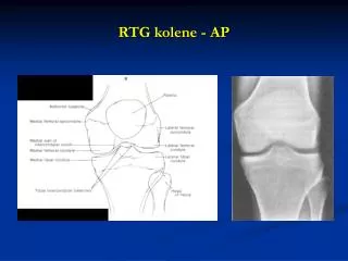 rtg kolene ap