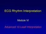 ECG Rhythm Interpretation - slide 1