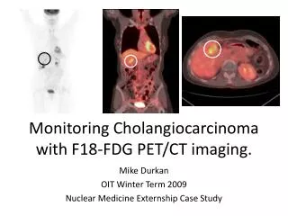 Monitoring Cholangiocarcinoma with F18-FDG PET/CT imaging.