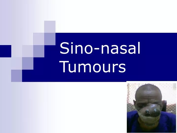 sino nasal tumours
