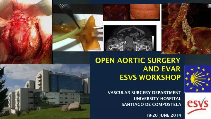 open aortic surgery and evar esvs workshop