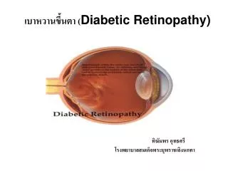 diabetic retinopathy