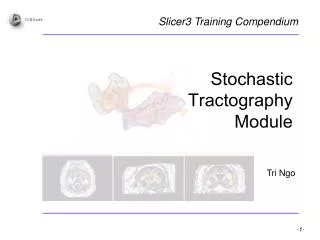 Stochastic Tractography Module