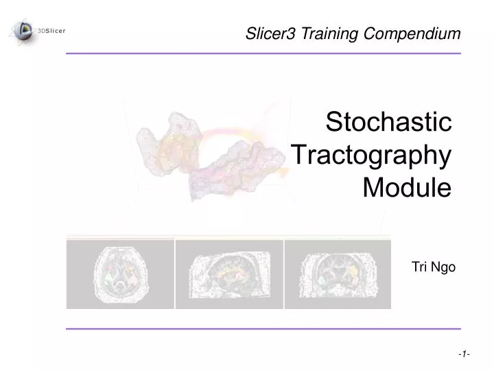 stochastic tractography module