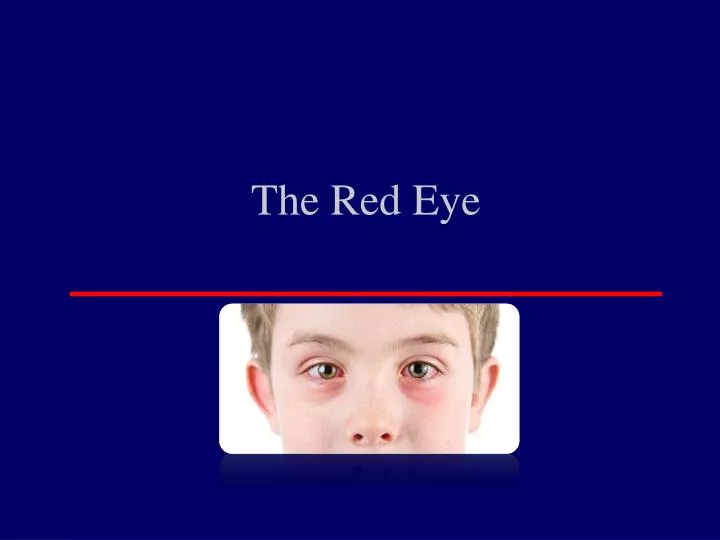 the red eye