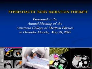 STEREOTACTIC BODY RADIATION THERAPY Presented at the Annual Meeting of the