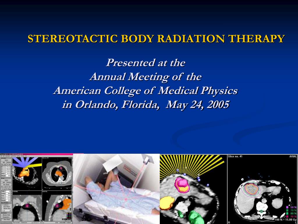 PPT - STEREOTACTIC BODY RADIATION THERAPY Presented at the Annual ...