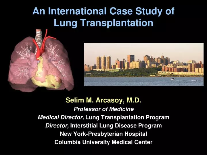 an international case study of lung transplantation