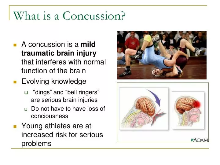 what is a concussion