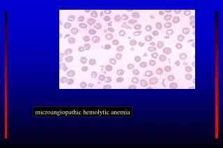 microangiopathic hemolytic anemia