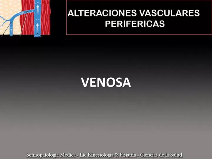 venosa