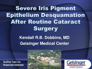 Severe Iris Pigment Epithelium Desquamation After Routine Cataract Surgery
