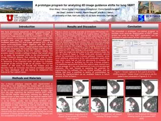 A prototype program for analyzing 4D image guidance shifts for lung SBRT