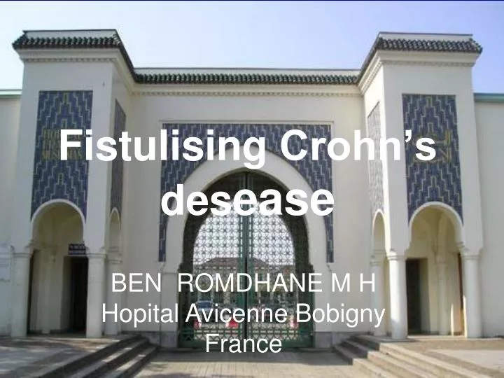 fistulising crohn s des ease